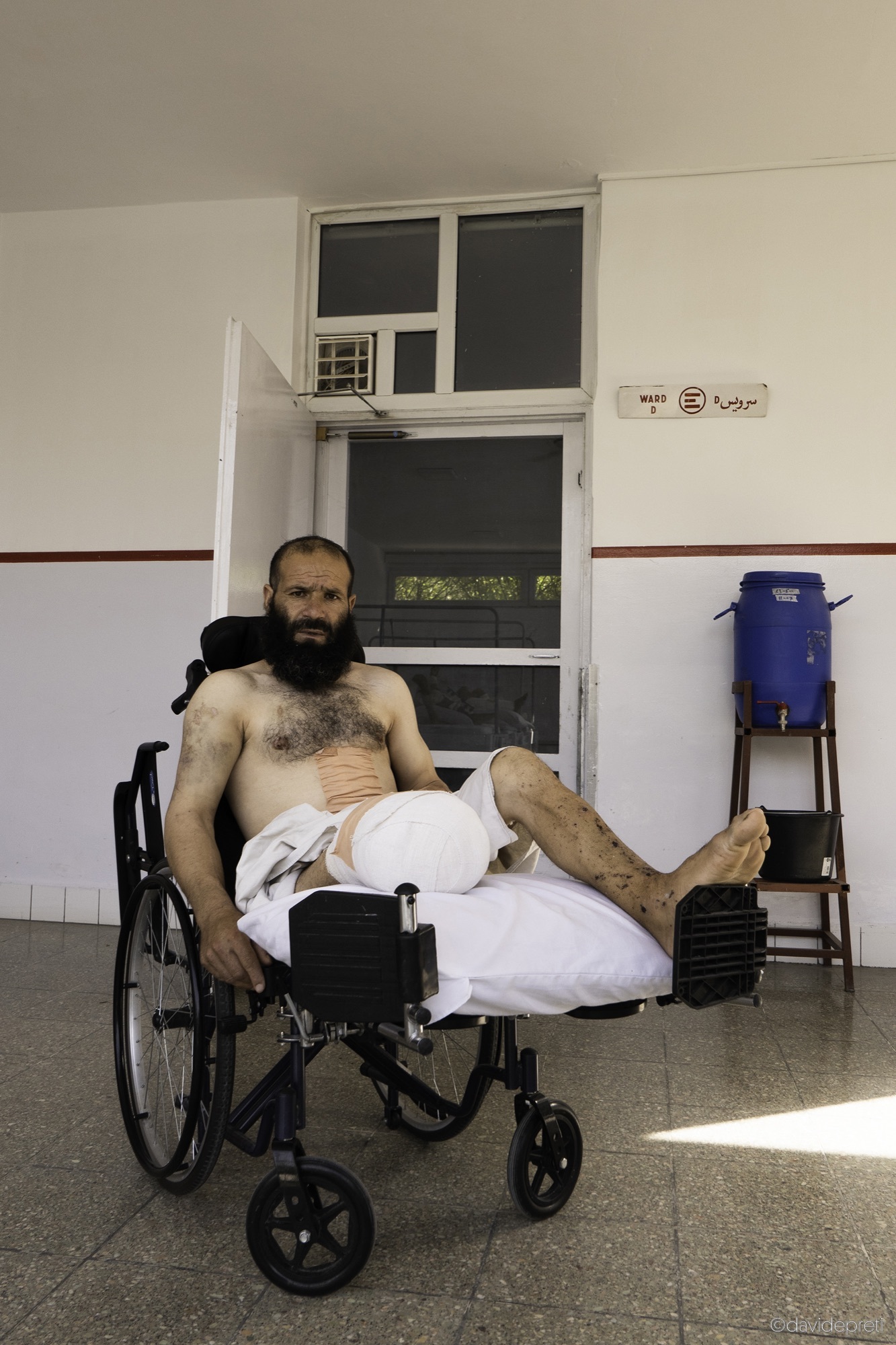 Kabul, Afghanistan — July 12, 2021.

JALAD KHAN - 39 yo

"I told my children not to leave the house," says Jalad Khan, sitting in his wheelchair outside the hospital ward where he is being treated. He is worried about his wife and seven children, who live in Darkh, in Logar province, where violence has become a daily occurrence. He has experienced its consequences firsthand.

"In the last 20 years, there have been no incidents like the one I was involved in in my village. But in the last month, three bombs have exploded and five people I knew have been killed. Some of my friends fled with their families; others decided to stay in the village."

Jalad Khan is a farmer. Together with his two brothers, he grows tomatoes, onions and potatoes in the fields around their village. As they were returning home for lunch, an IED exploded near their car. Jalad Khan suffered severe injuries to his lower limbs and abdomen. His older brother carried him on his shoulders to the nearest clinic. After receiving initial treatment, he was immediately transferred to our hospital in Kabul, where he arrived in critical condition. Because of the extent of his injuries, we had to amputate his right leg.

Jalad Khan does not want to leave his homeland. But today, he cannot imagine a future there for himself and his family.
