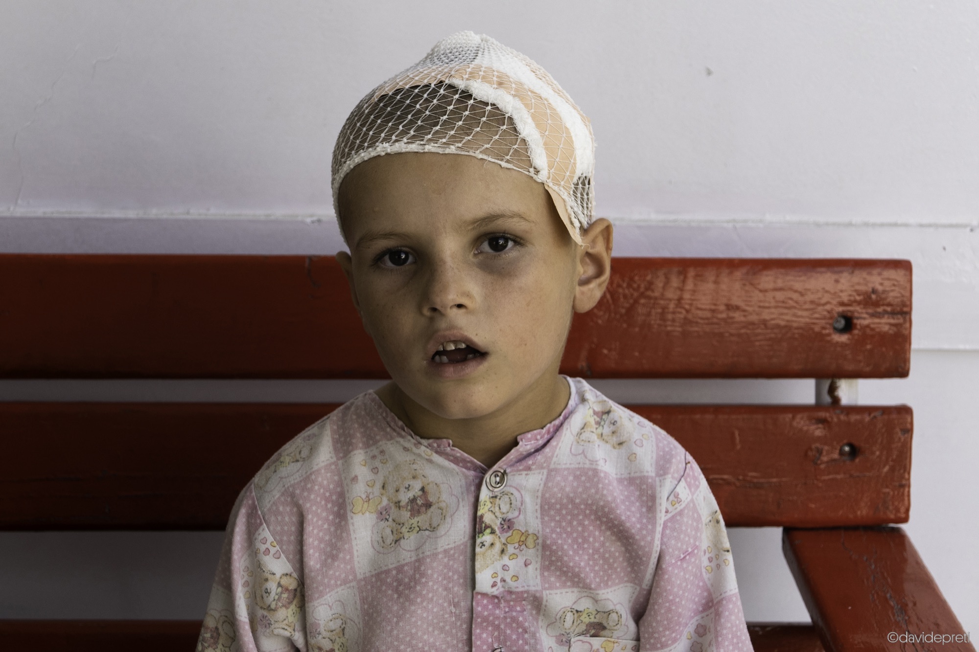 Kabul, Afghanistan — July 17, 2021.

ABDULLAH - 7 yo

Abdullah was wounded by a bullet while at home in Ghazni province. The province is strategically important because it is crossed by Highway 1, also known as the Ring Road, which connects Kabul to Kandahar and continues to Herat.

Although Ghazni is only about 100 km from Kabul, it took the ambulance more than five hours to reach the EMERGENCY Surgical Centre for War Victims in the capital, due to numerous checkpoints and the rough road, damaged by the fighting.

Abdullah is now recovering in the C-Ward (Children's Ward). If his follow-up examinations show that he is recovering well, he is expected to be discharged in the coming weeks.
