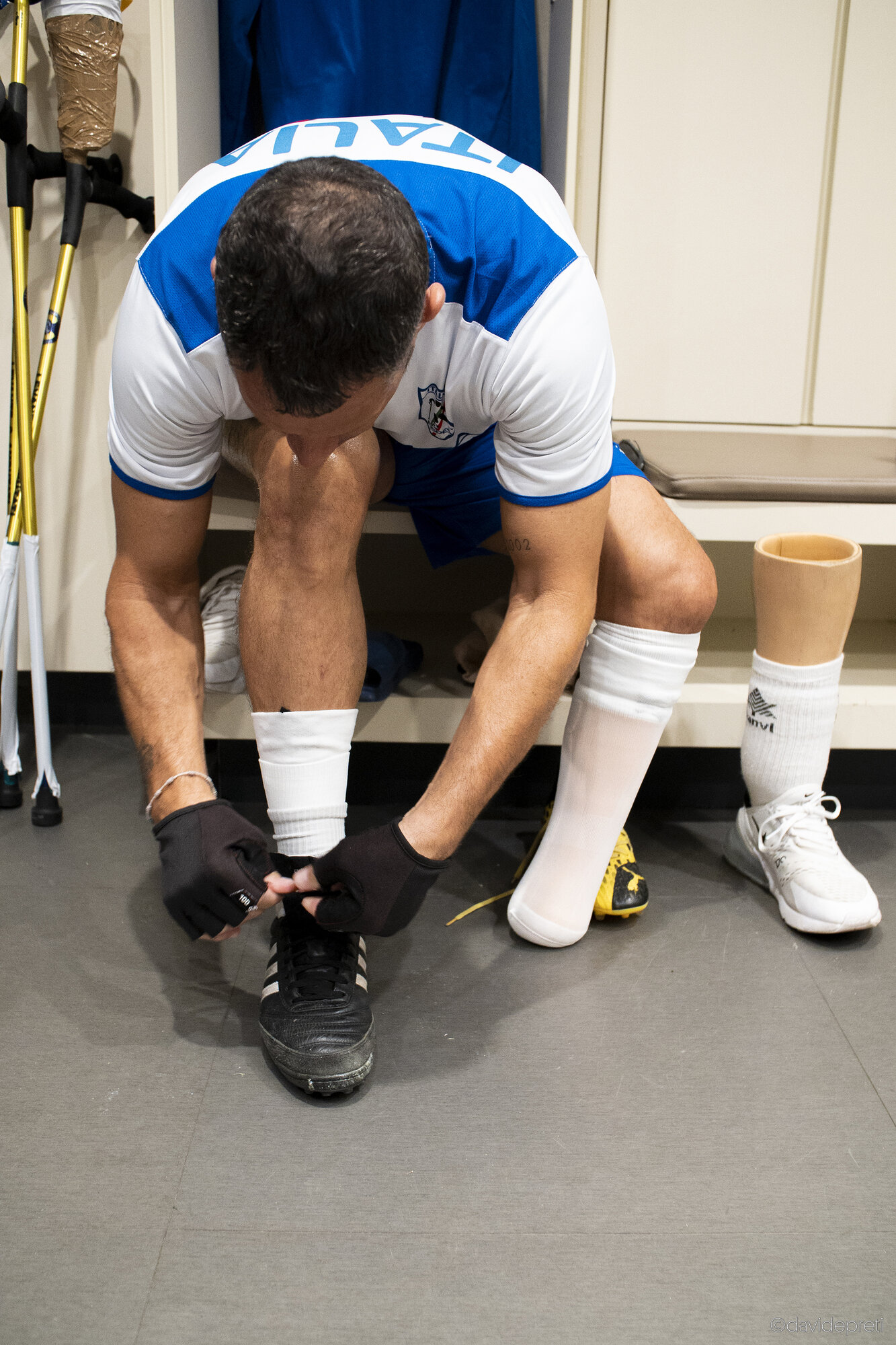 Istanbul, Turkey — October 7, 2022.

An Italian amputee football player lacing his boot before the start of a game at the Amputee Football World Cup.

