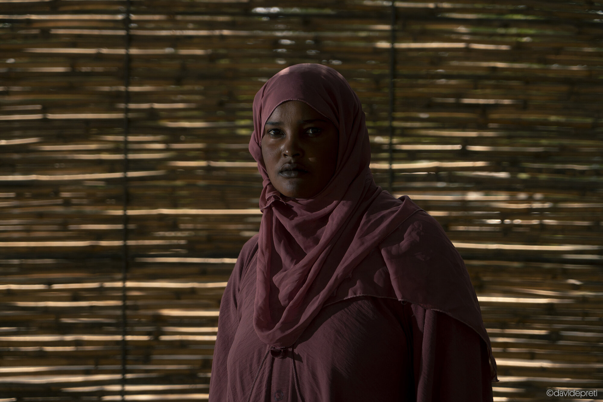 Khartoum, Sudan — November 16, 2025.

H. - 21 yo

"I'll never be as happy as I was before," she says. She is at the Salam Centre in Khartoum to check her blood coagulation levels. She had heart surgery here in 2012.

Now, she lives in a tent outside the gates with her father, who sells produce at the market. Every day she takes Warfarin to keep her mechanical heart valve from failing.

H. comes from a farming village in North Kordofan. In February 2025, RSF paramilitaries stormed her family's land, occupied the farm, and beat her father. During the assault, H. was raped. She fled with her family, leaving her medication behind. She and her father began the long journey towards the capital.

In Omdurman, she discovered she had become pregnant as a result of the assault and chose to have an abortion. She is back on her medication now. If the therapy works, she will avoid another surgery.

But the despair in her eyes remains. "I will never be as happy as I was before."
