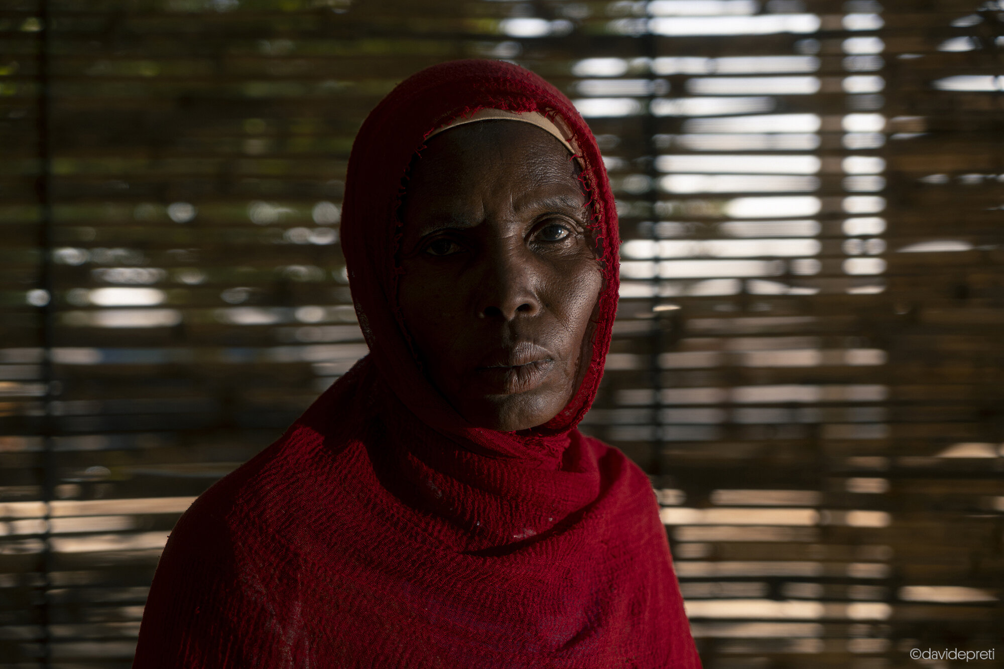 Khartoum, Sudan — November 20, 2025.

D. - 46 yo

She lives with a heart operated on at EMERGENCY's Salam Centre. Her life depends on Warfarin, a drug the war has made impossible to find. When shelling hit her neighborhood in El Fasher in May 2024, she began a flight through refugee camps and besieged cities. Her family scattered: one daughter ended up in Chad, while her husband and a son reached Egypt.

Left alone with three children, she decided to reach Khartoum in August 2025. It was the only way to obtain the medication and the check-ups her heart required. The journey for four people cost 3,000,000 dinars — before the conflict, it would have cost 80. Today she lives in Omdurman, dreaming of her home. "I used to make tea for my grandchildren after school and we would talk about the day," she says. "That is what I miss the most."

